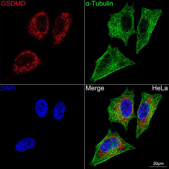 GSDMD Antibody in Immunocytochemistry (ICC/IF)