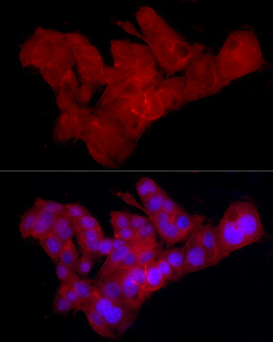 Claudin 1 Antibody in Immunocytochemistry (ICC/IF)