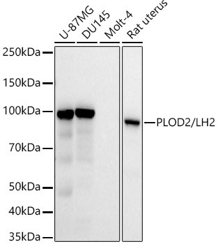 PLOD2 Antibody in Western Blot (WB)