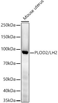 PLOD2 Antibody in Western Blot (WB)