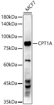 CPT1A Antibody in Western Blot (WB)