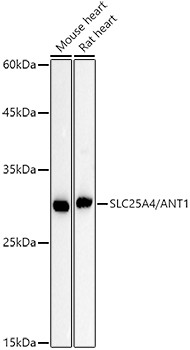 ANT Antibody in Western Blot (WB)