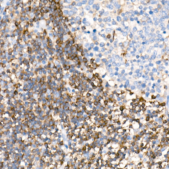 PKC beta Antibody in Immunohistochemistry (Paraffin) (IHC (P))