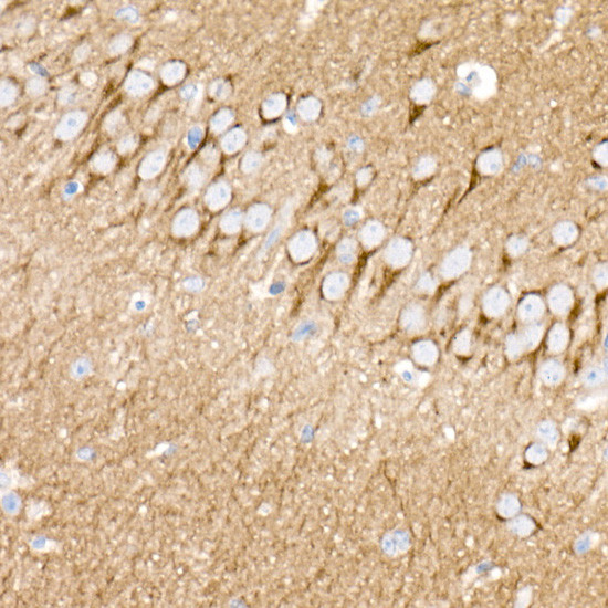 PKC beta Antibody in Immunohistochemistry (Paraffin) (IHC (P))