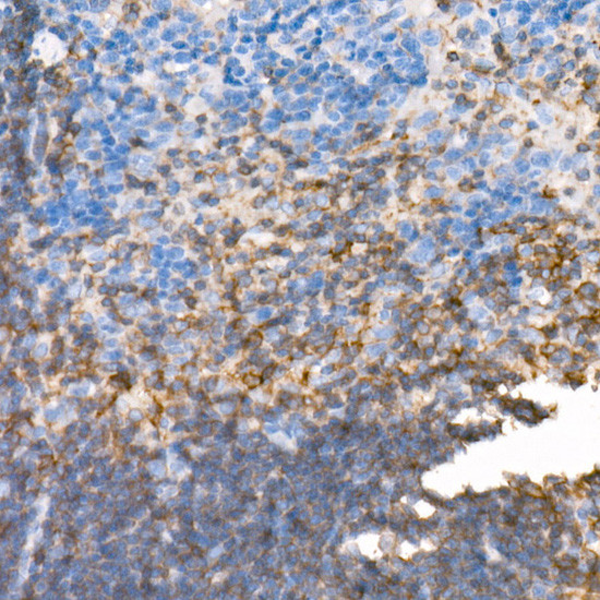 PKC beta Antibody in Immunohistochemistry (Paraffin) (IHC (P))