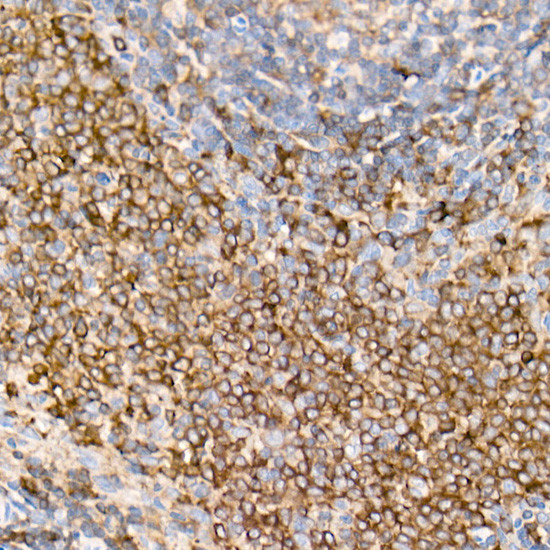 PKC beta Antibody in Immunohistochemistry (Paraffin) (IHC (P))