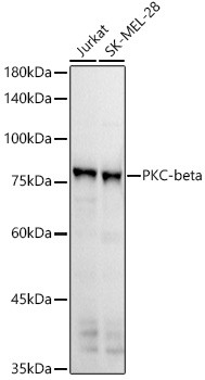 PKC beta Antibody in Western Blot (WB)