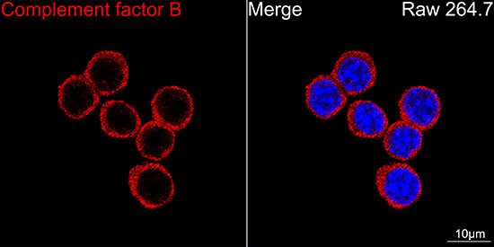 Complement Factor B Antibody in Immunocytochemistry (ICC/IF)