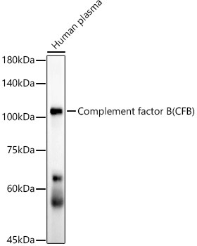 Complement Factor B Antibody in Western Blot (WB)