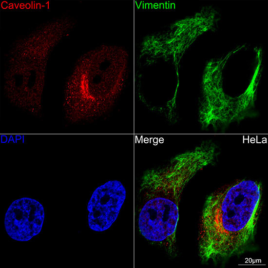 Caveolin 1 Antibody in Immunocytochemistry (ICC/IF)