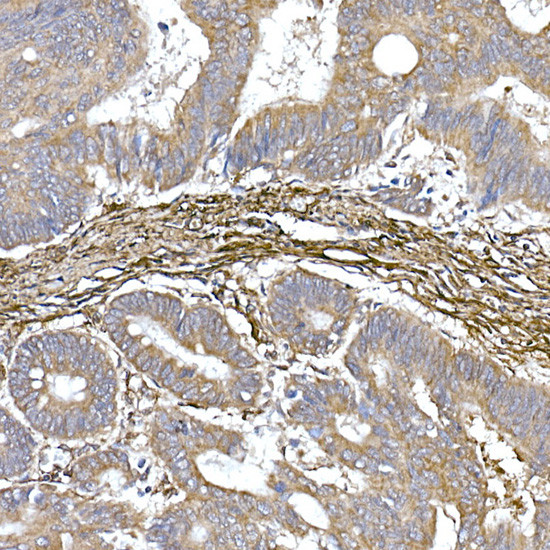 Caveolin 1 Antibody in Immunohistochemistry (Paraffin) (IHC (P))