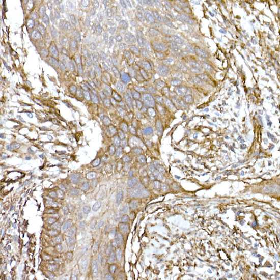 Caveolin 1 Antibody in Immunohistochemistry (Paraffin) (IHC (P))