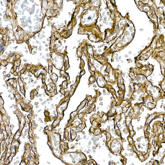 Caveolin 1 Antibody in Immunohistochemistry (Paraffin) (IHC (P))