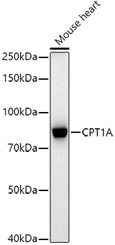 CPT1A Antibody in Western Blot (WB)