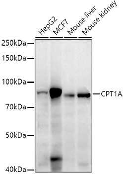 CPT1A Antibody in Western Blot (WB)