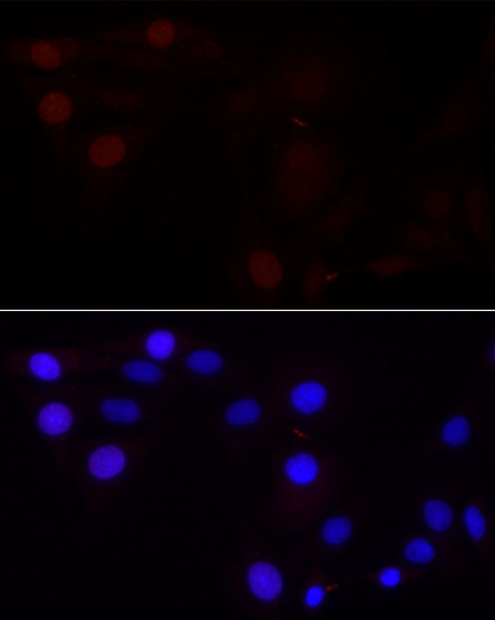 Aurora B Antibody in Immunocytochemistry (ICC/IF)