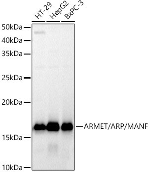 ARMET Antibody in Western Blot (WB)