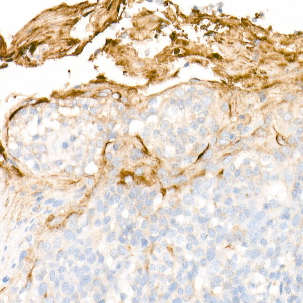 Clusterin Alpha Antibody in Immunohistochemistry (Paraffin) (IHC (P))