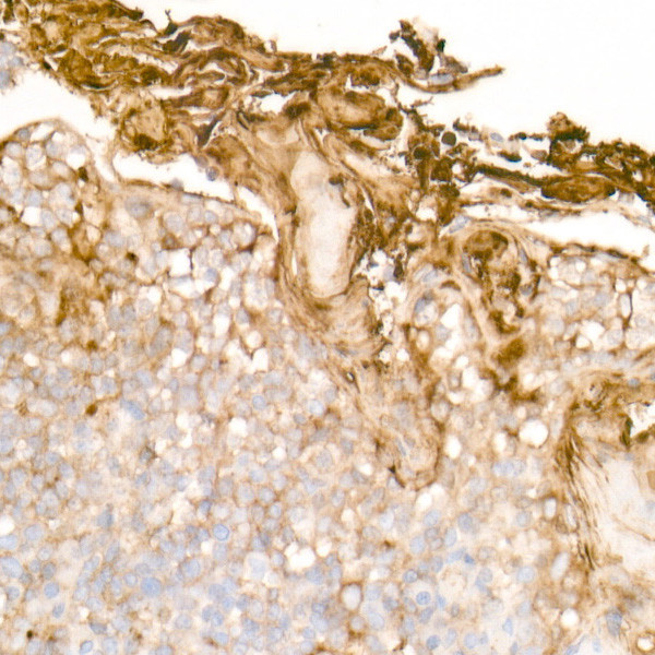 Clusterin Alpha Antibody in Immunohistochemistry (Paraffin) (IHC (P))