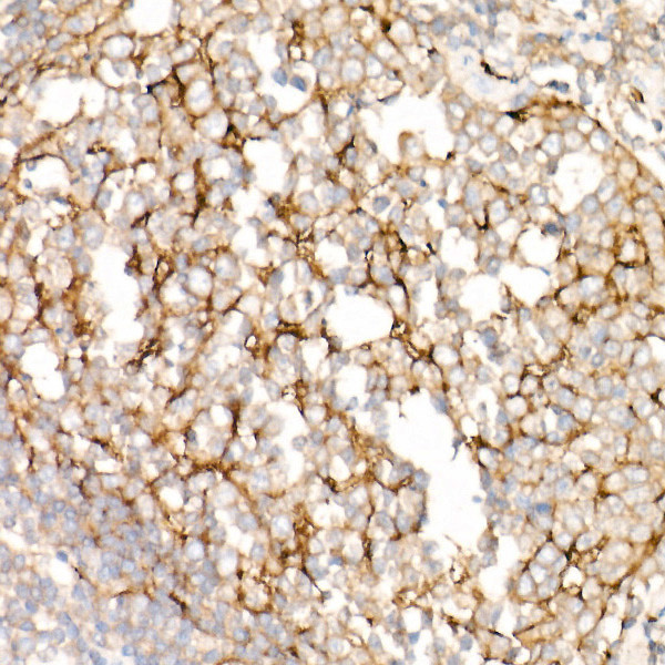 Clusterin Alpha Antibody in Immunohistochemistry (Paraffin) (IHC (P))