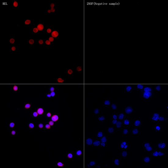 Calretinin Antibody in Immunocytochemistry (ICC/IF)