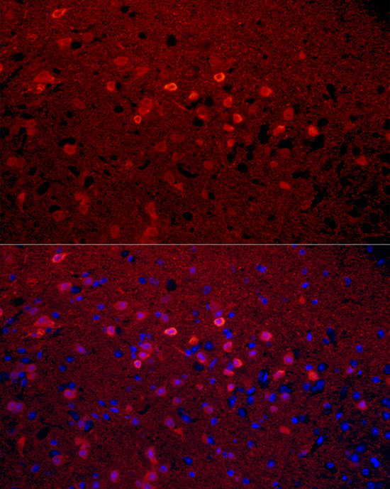 Calretinin Antibody in Immunocytochemistry (ICC/IF)