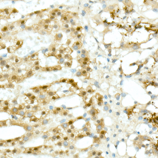 Calretinin Antibody in Immunohistochemistry (Paraffin) (IHC (P))