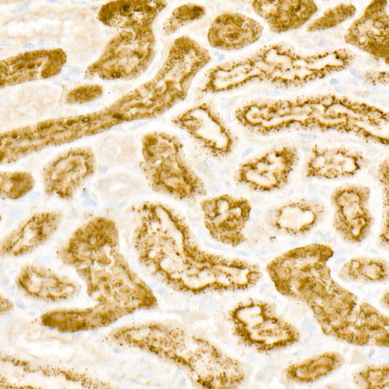 RHOT1 Antibody in Immunohistochemistry (Paraffin) (IHC (P))