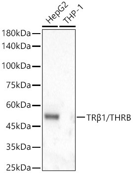 THRB Antibody in Western Blot (WB)