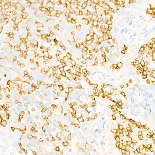 IL23R Antibody in Immunohistochemistry (Paraffin) (IHC (P))