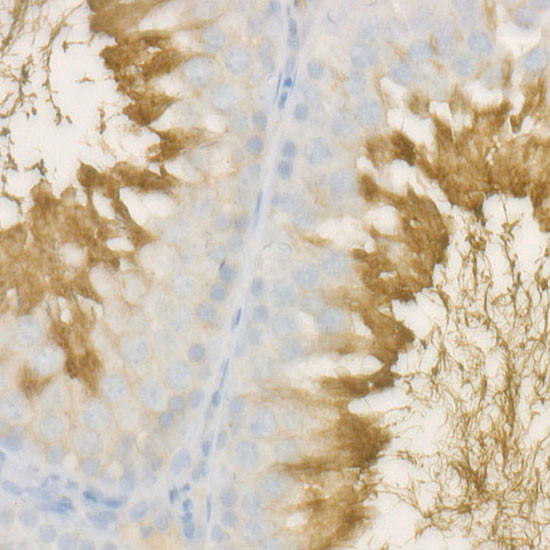 SPAM1 Antibody in Immunohistochemistry (Paraffin) (IHC (P))