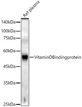 GC Antibody in Western Blot (WB)