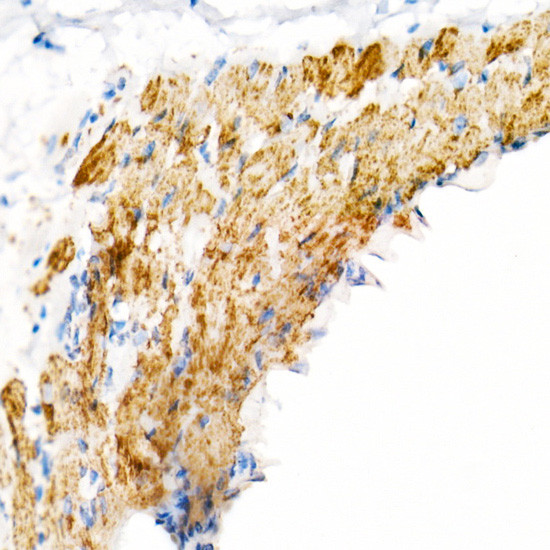 VDAC2 Antibody in Immunohistochemistry (Paraffin) (IHC (P))