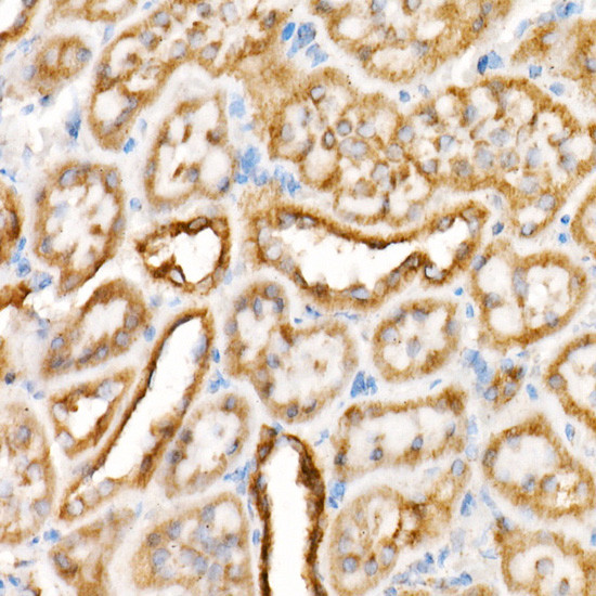 VDAC2 Antibody in Immunohistochemistry (Paraffin) (IHC (P))