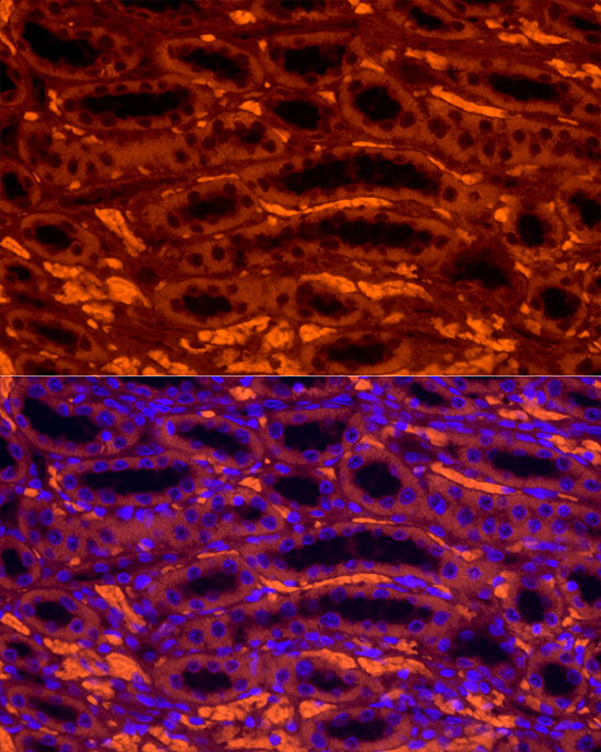 IGF2BP1 Antibody in Immunocytochemistry (ICC/IF)