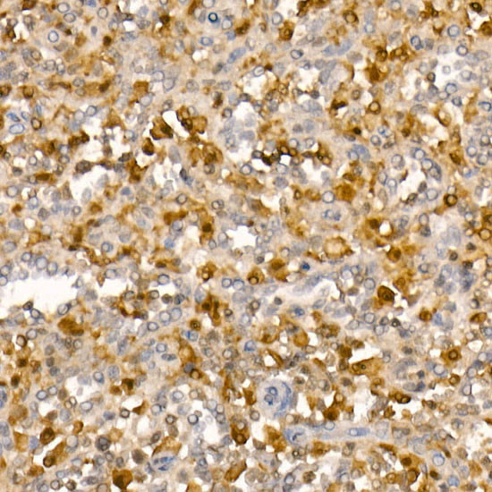 PYCARD Antibody in Immunohistochemistry (Paraffin) (IHC (P))