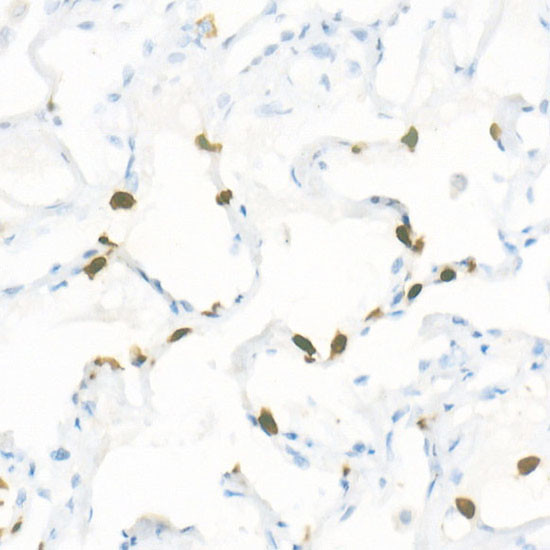 S100A9 Antibody in Immunohistochemistry (Paraffin) (IHC (P))