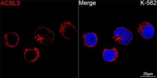 ACSL3 Antibody in Immunocytochemistry (ICC/IF)