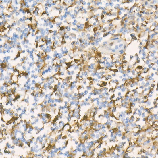 Gelsolin Antibody in Immunohistochemistry (Paraffin) (IHC (P))