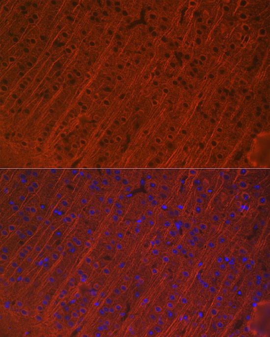 MAP2 Antibody in Immunocytochemistry (ICC/IF)