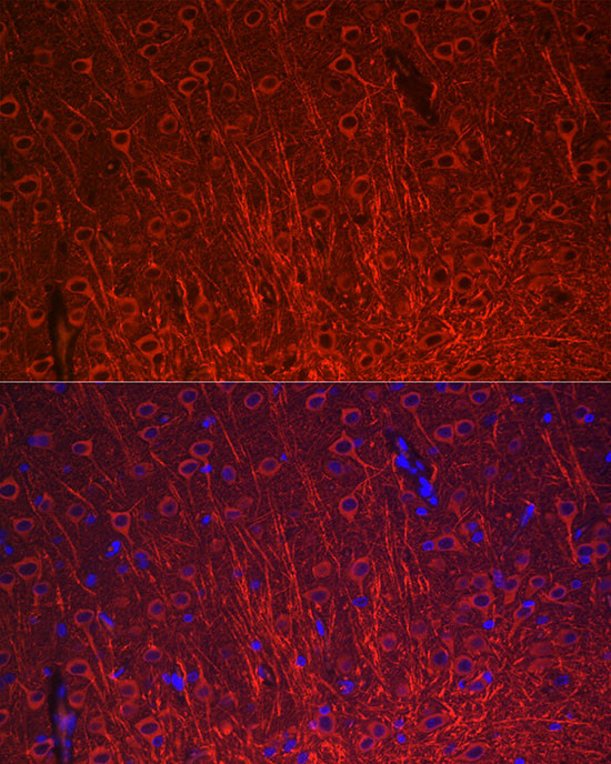 MAP2 Antibody in Immunocytochemistry (ICC/IF)