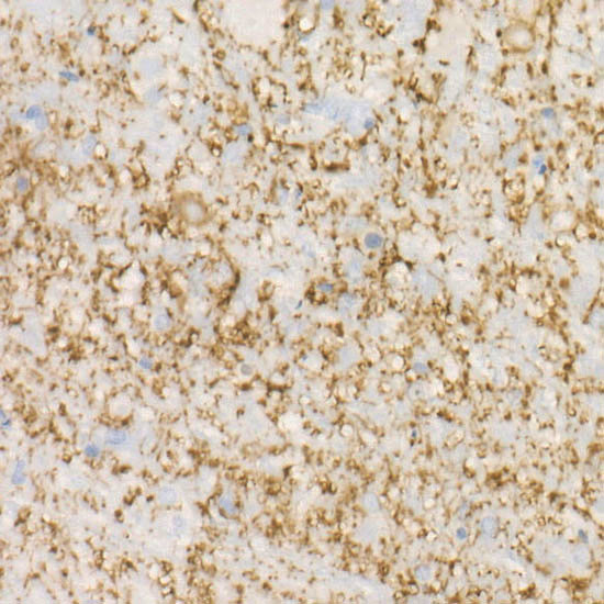 MAP2 Antibody in Immunohistochemistry (Paraffin) (IHC (P))