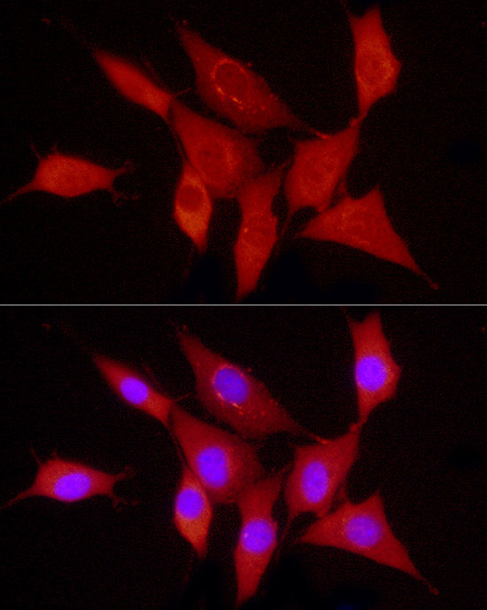 PDGF-B Antibody in Immunocytochemistry (ICC/IF)