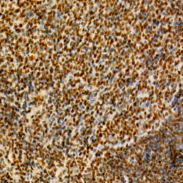 Rb Antibody in Immunohistochemistry (Paraffin) (IHC (P))