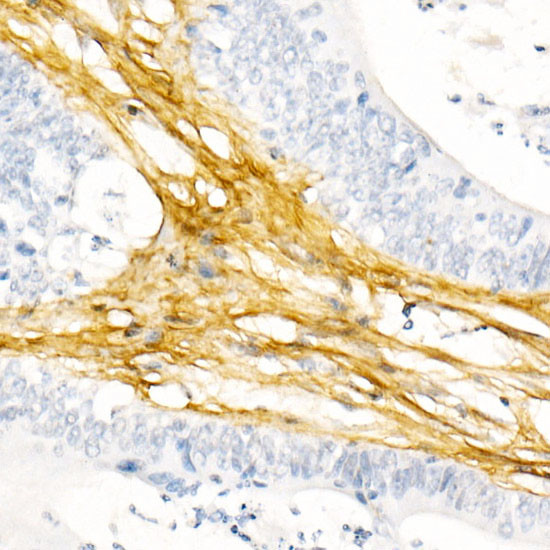 COL1A1 Antibody in Immunohistochemistry (Paraffin) (IHC (P))