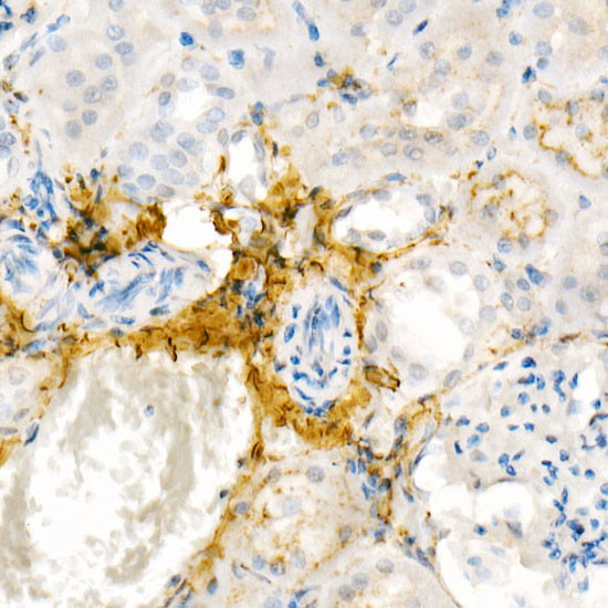 COL1A1 Antibody in Immunohistochemistry (Paraffin) (IHC (P))