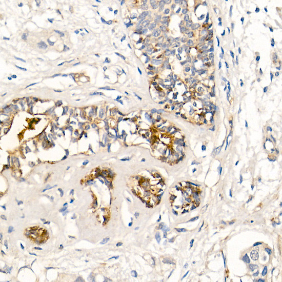 MMP7 Antibody in Immunohistochemistry (Paraffin) (IHC (P))