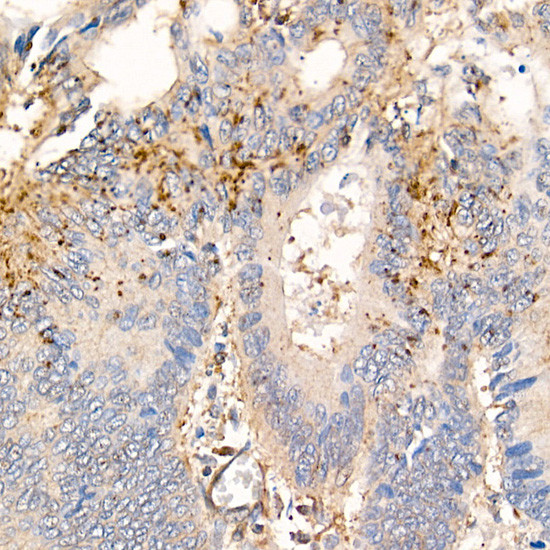 MMP7 Antibody in Immunohistochemistry (Paraffin) (IHC (P))