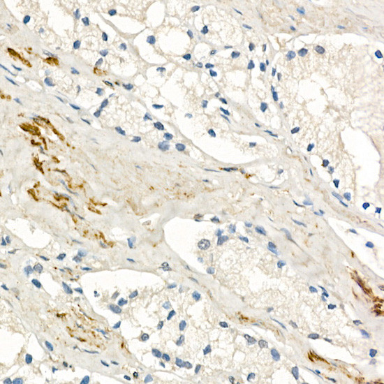 MMP7 Antibody in Immunohistochemistry (Paraffin) (IHC (P))