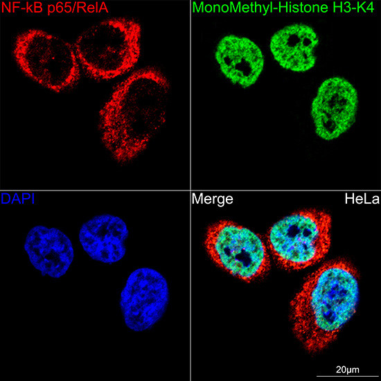 NFkB p65 Antibody in Immunocytochemistry (ICC/IF)